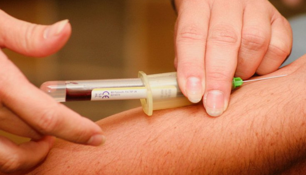 New blood tests could detect Alzheimer’s decades before symptoms