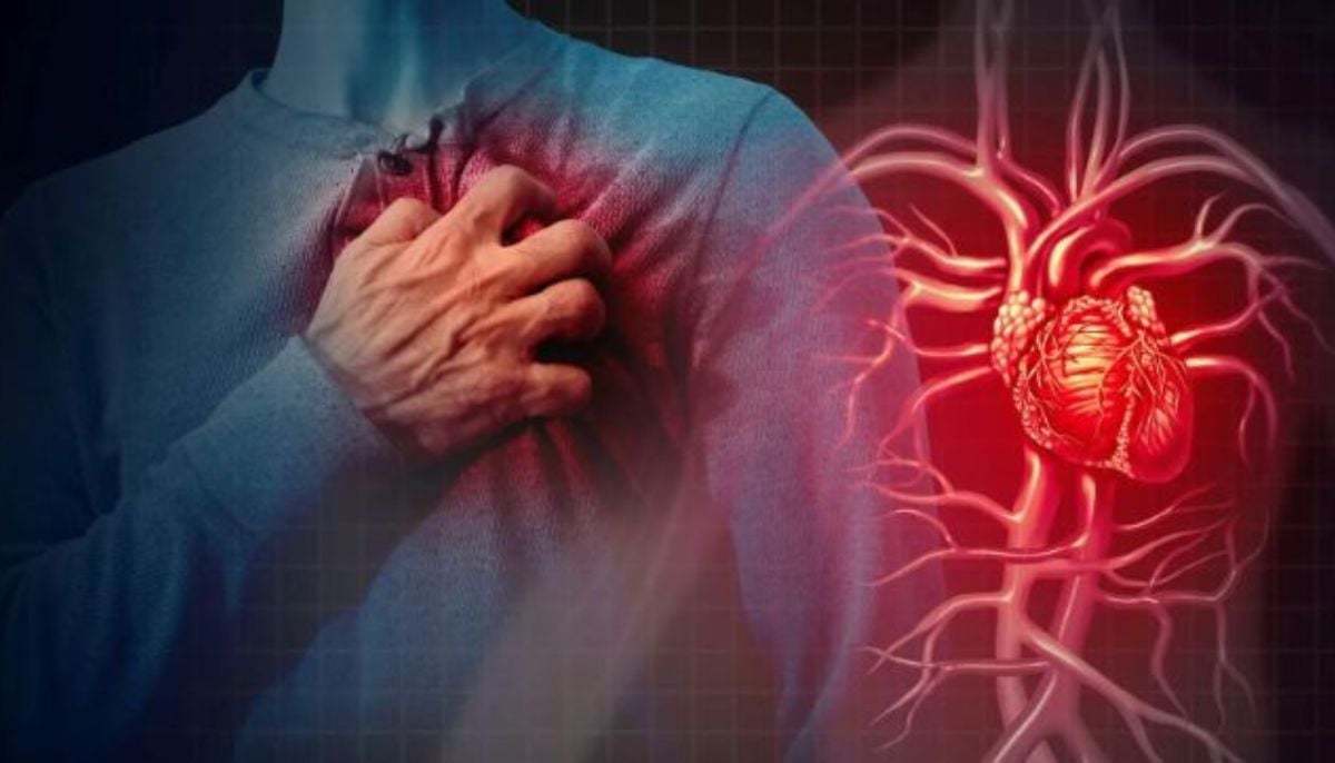 Cardiologist reveals biggest myth about heart attacks