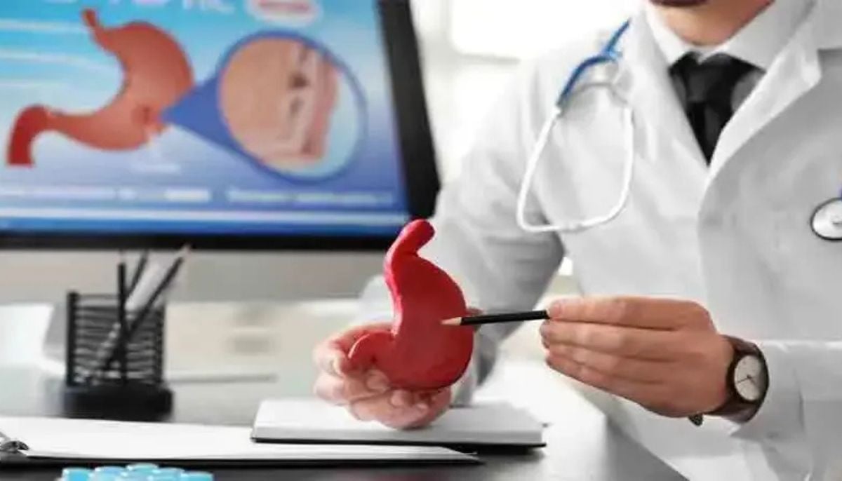 Why younger adults are facing a higher risk of colon cancer today