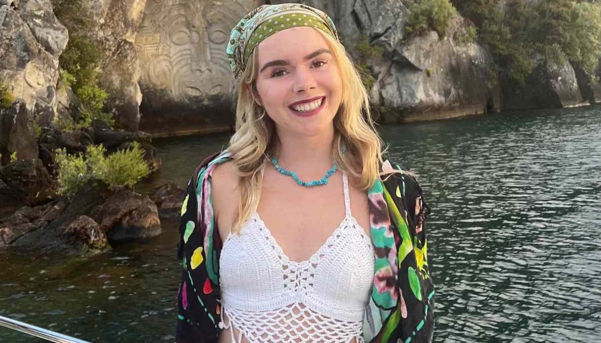 Former Pageant Queen Zoe Morgan opens up about severe acne journey 