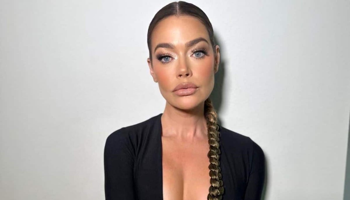Denise Richards chooses honesty after facelift reveal amid divorce drama