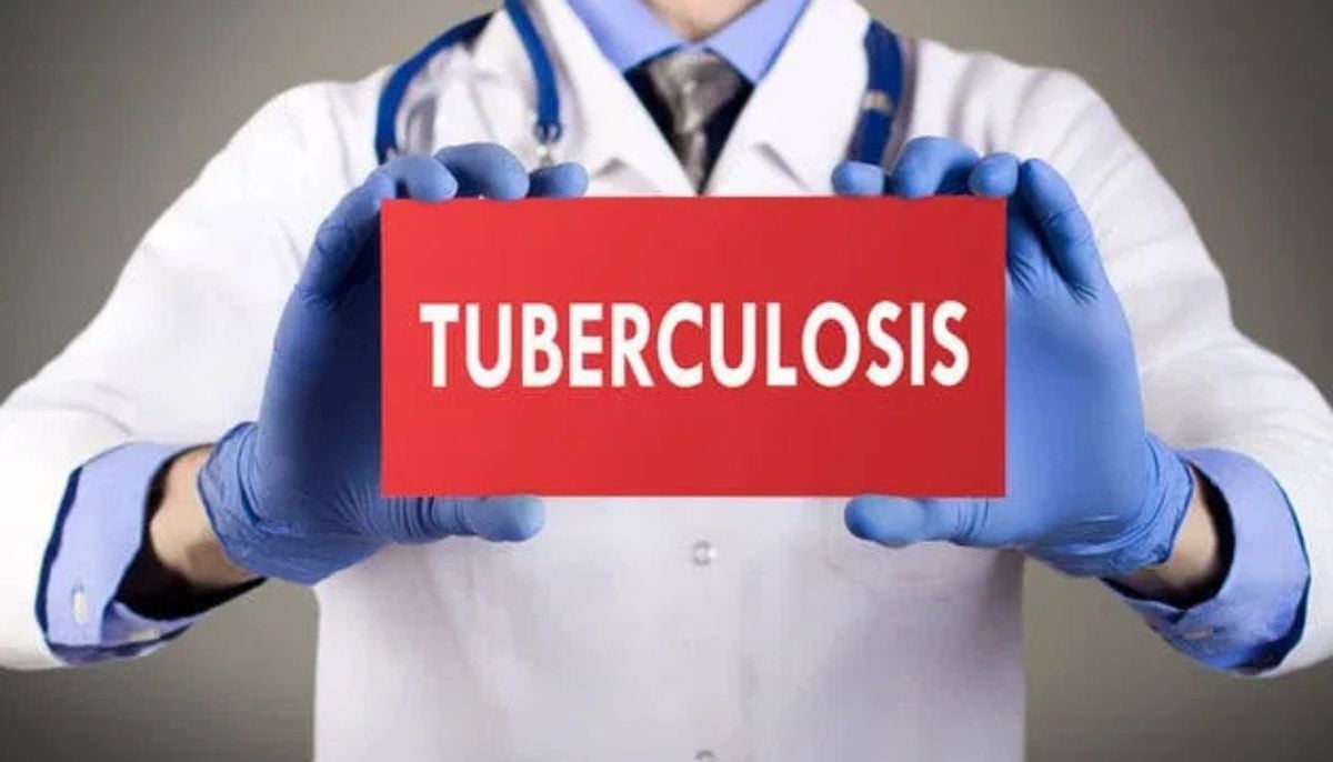 Expert reveals common misconceptions hindering global tuberculosis diagnosis and treatment