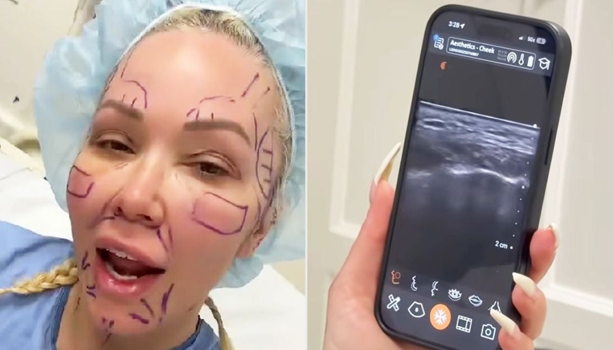 Bunnie Xo claims facelift feels 'choking' during recovery journey