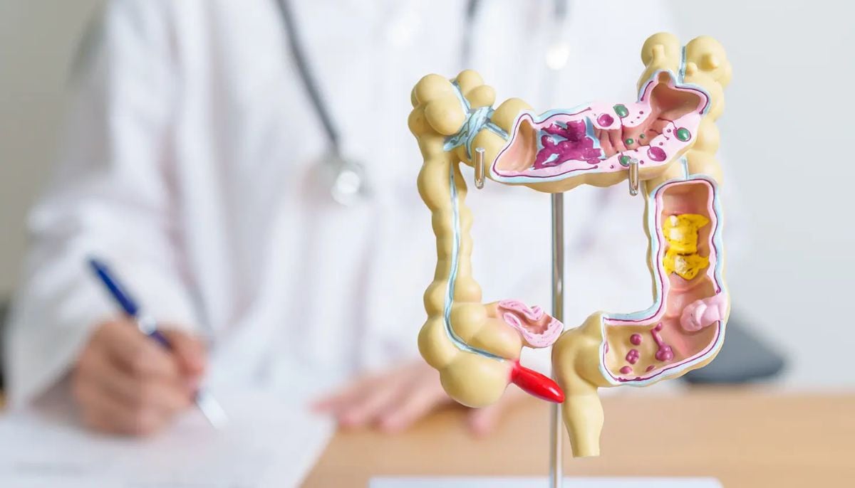 How to recognise warning signs of colorectal disease