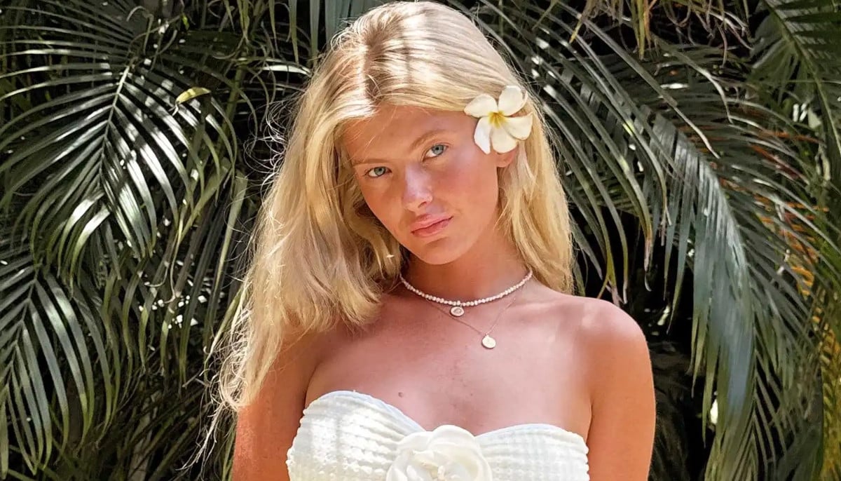 Kylie Darling responds to criticism over cosmetic procedures: &amp;apos;confidence comes first&amp;apos;