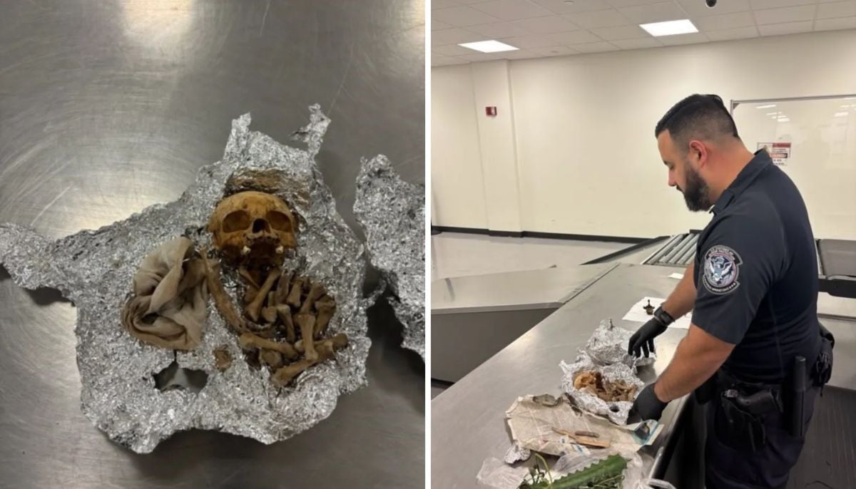 Skull found after man mentions cremation, skeletal remains discovered