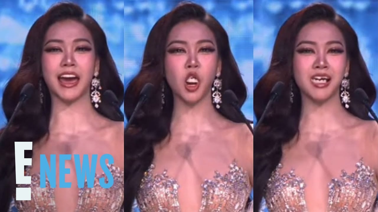 A pageant pro stays composed as teeth fall out during on-stage introduction
