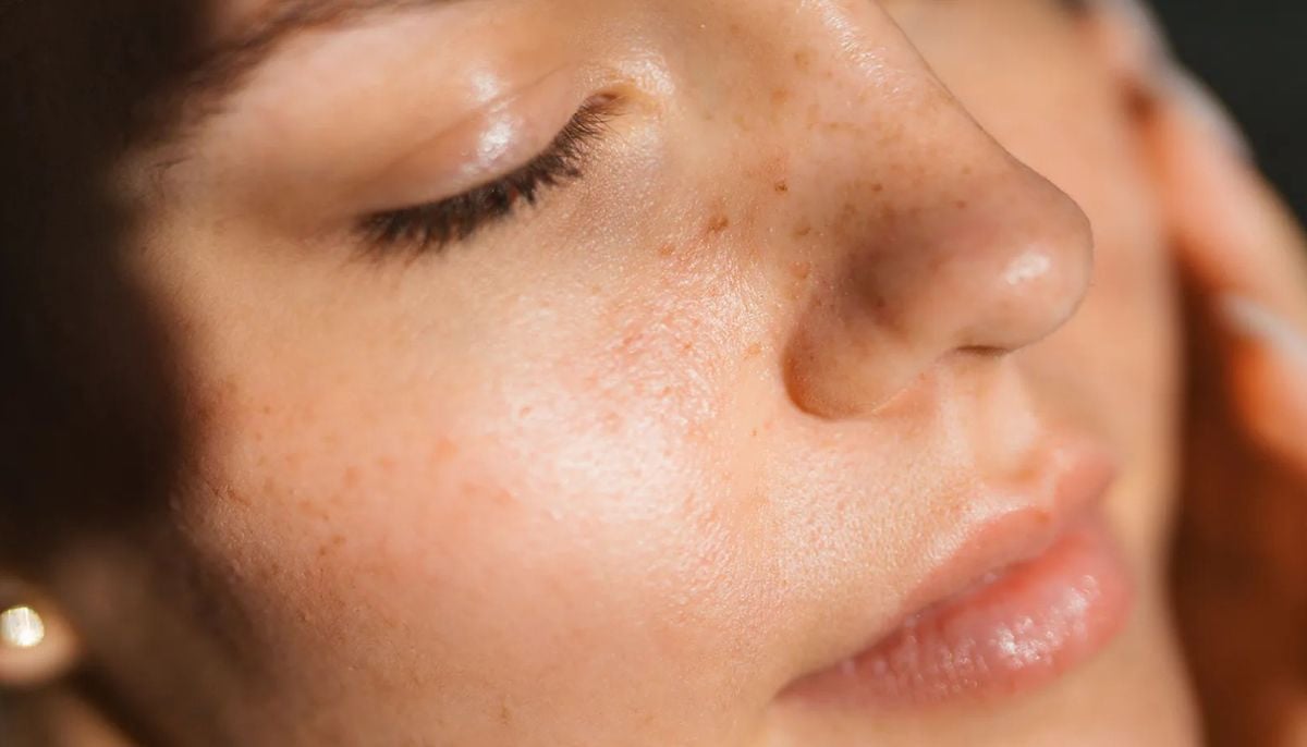 How to identify dehydrated skin through texture changes and increased sensitivity