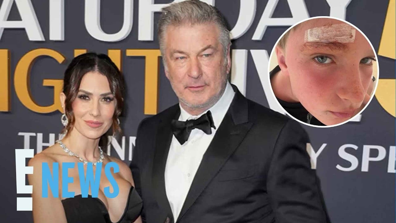 Hilaria Baldwin shares details of son Leo’s hospital visit after beach vacation injury