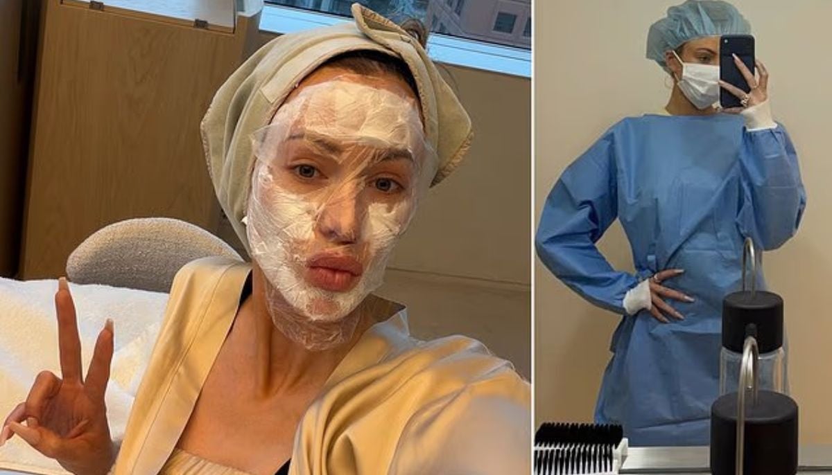 Olivia Attwood mimics Kim Kardashian with stem cell treatment on TV