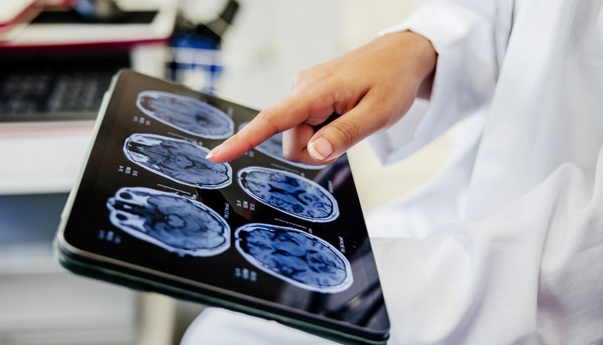 Scientists pinpoint single protein driving age-related memory loss