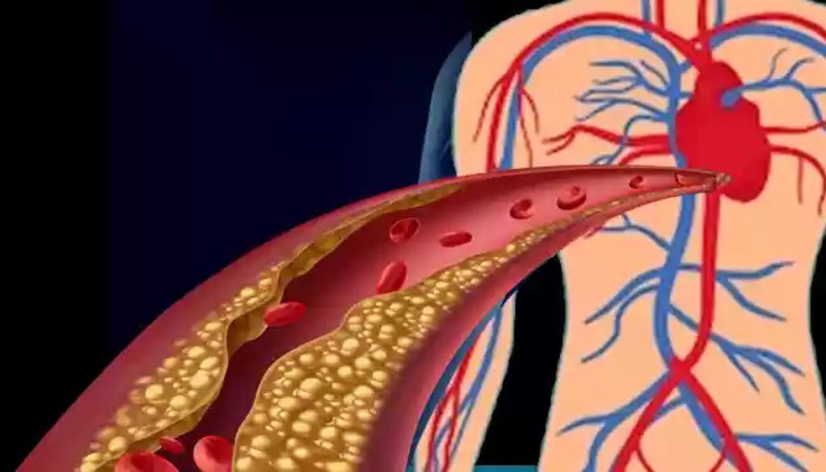 How to identify silent markers for cardiovascular and brain health