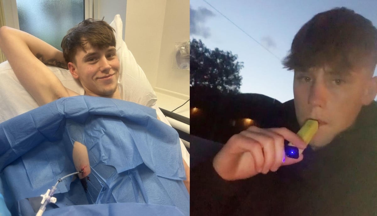 UK teen shares warning after vaping addiction results in collapsed lung