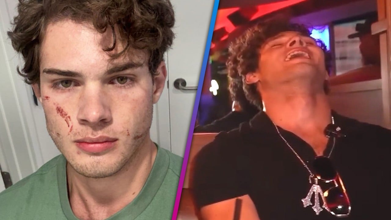 Influencer Clavicular speaks out after harrowing overdose caught on livestream