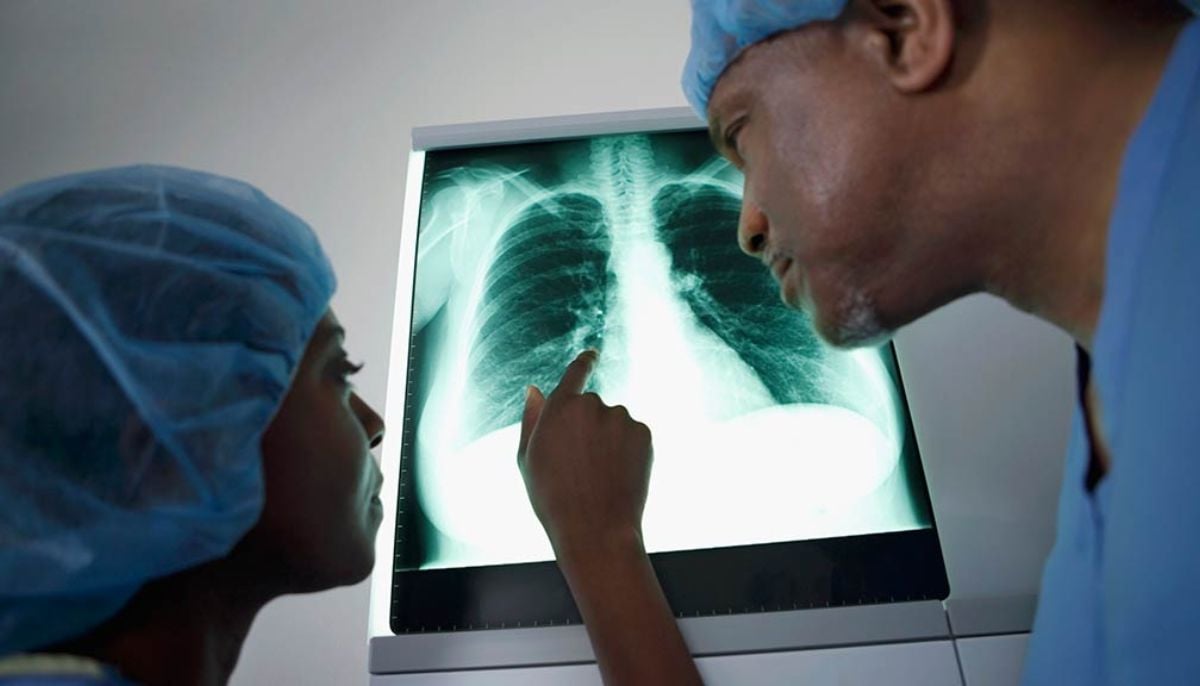 Are X-ray scans harmful? Radiologist debunks 5 health myths from social media