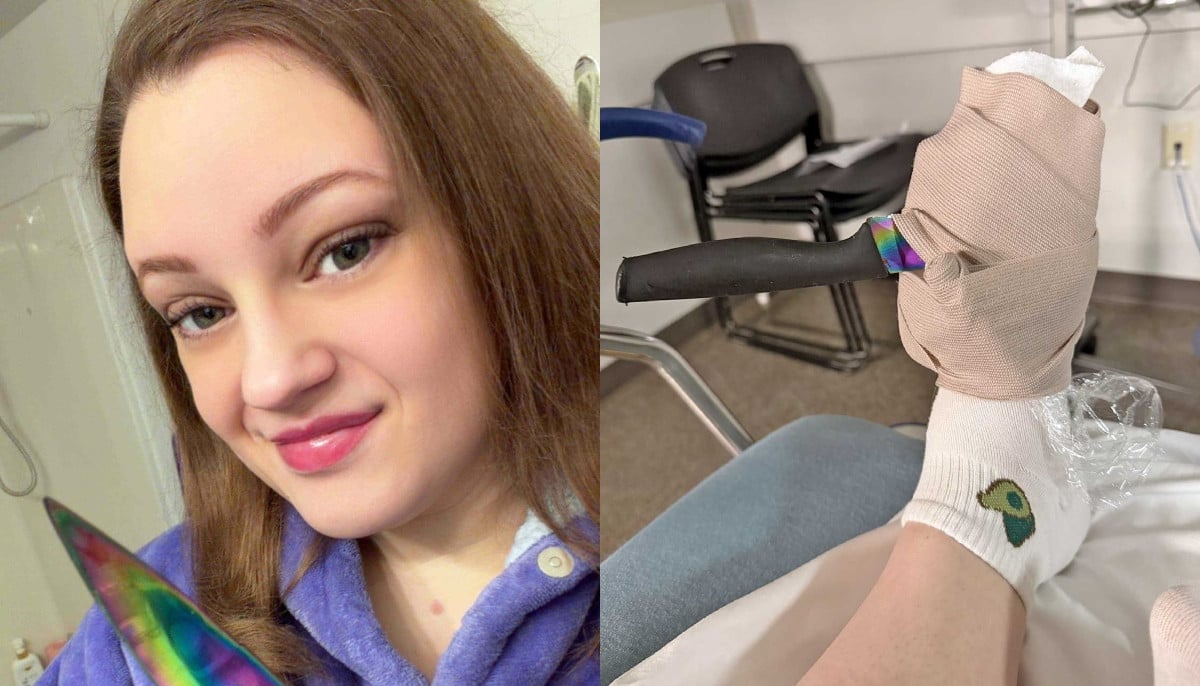 Knife slip during dishwashing leads to life-saving diagnosis for Michigan woman