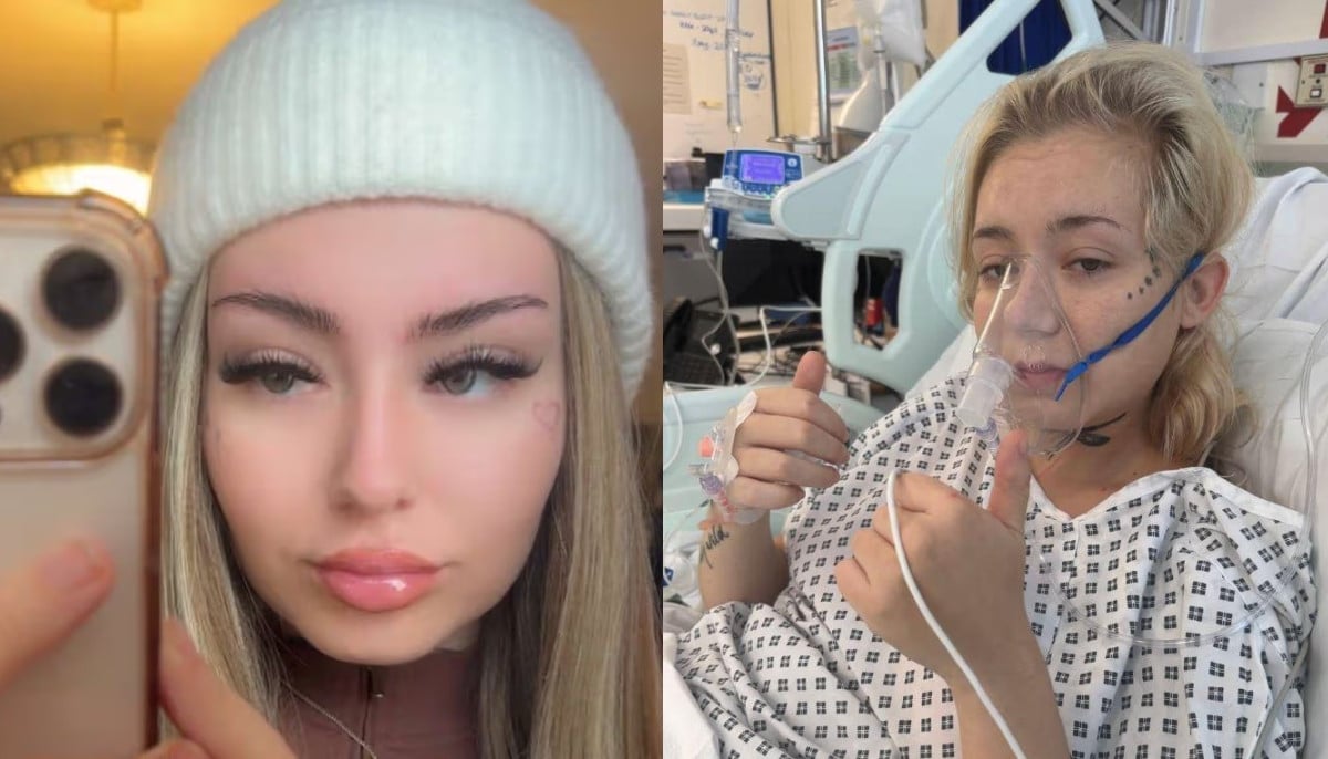 A young teen faces terminal lung cancer after vaping history