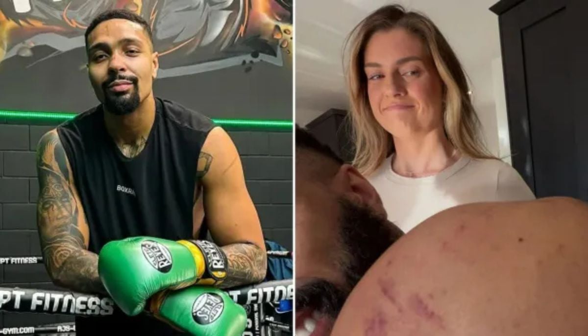 Jordan Banjo's wife accuses 'I'm A Celebrity' star of cheating over shoulder bruises