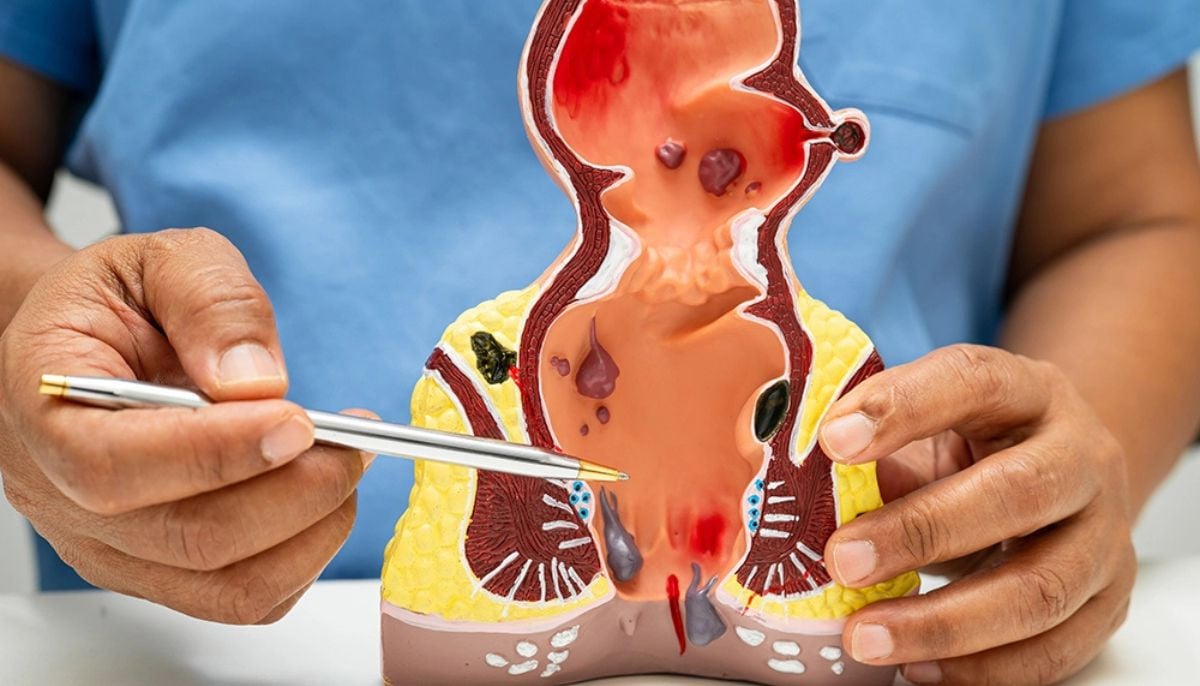 Taking your phone to the toilet could cause haemorrhoids and even costly surgery
