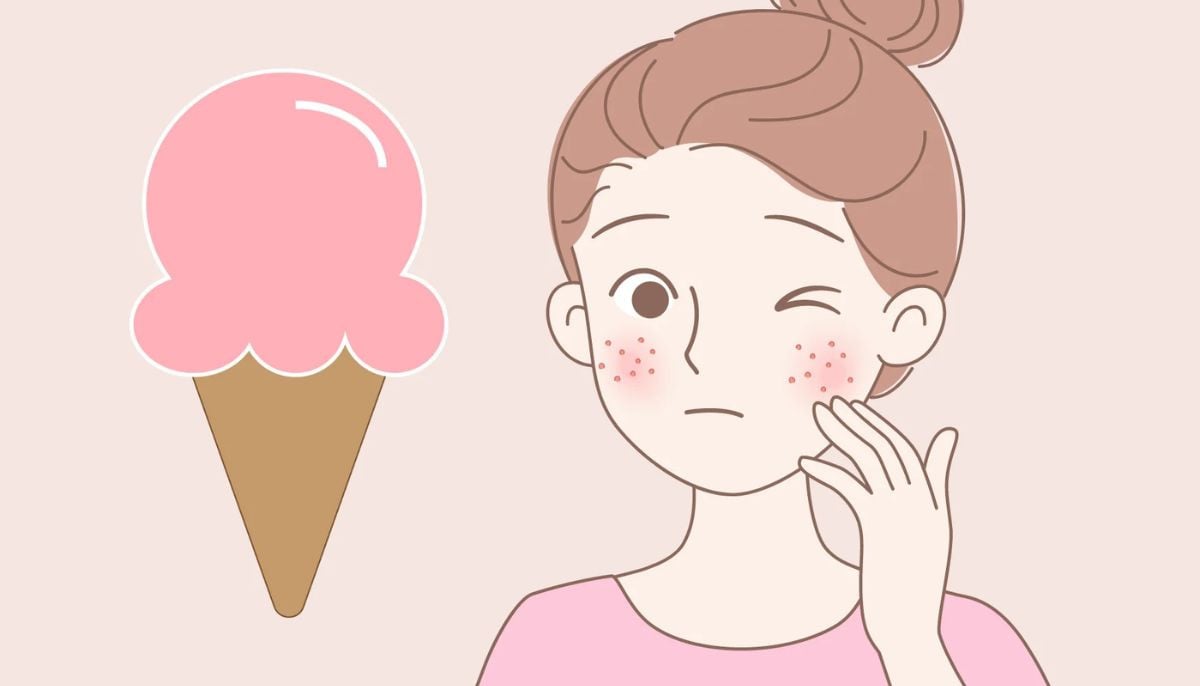 Summer acne flare-ups could be linked to what you eat, says a dermatologist