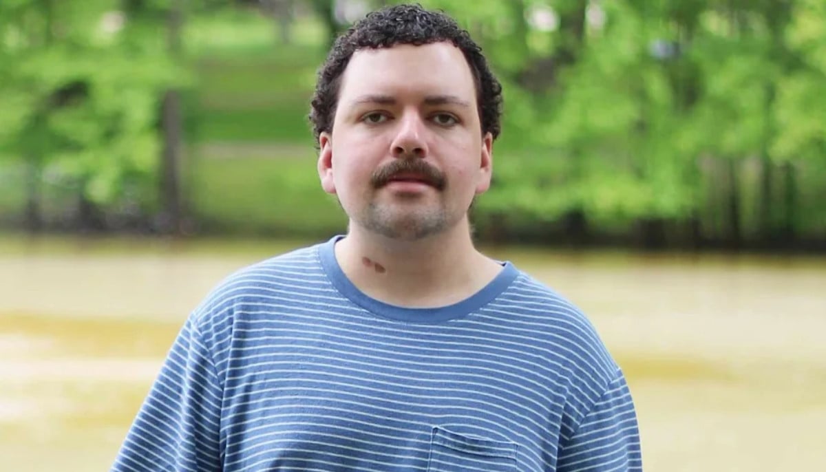 Barista who Drank 8 espresso shots daily to fight fatigue later diagnosed with stage II cancer
