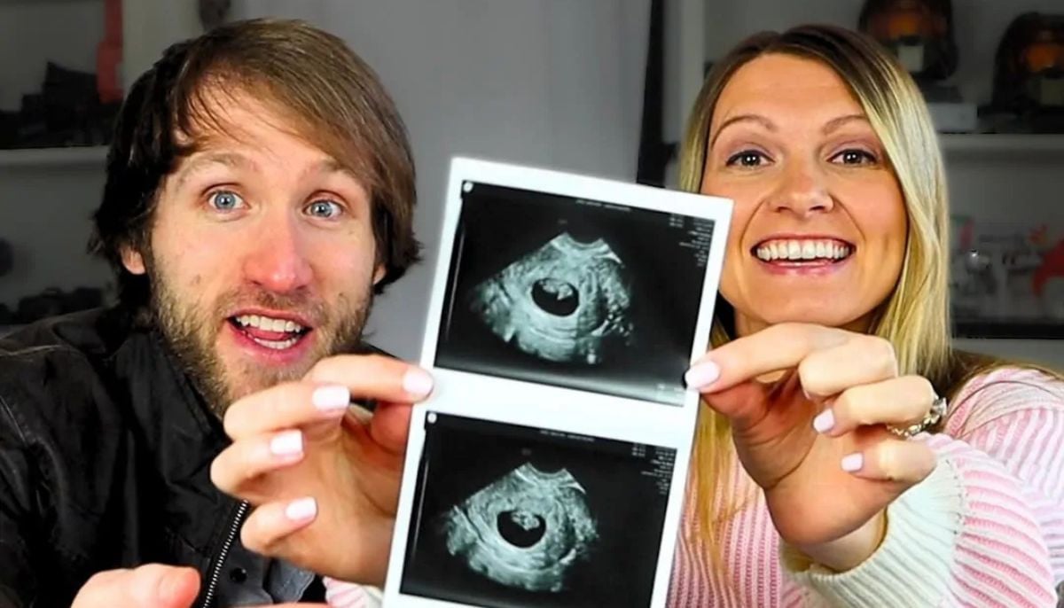 Jesse Ridgway and wife Ashley terminate pregnancy after Trisomy 21 diagnosis