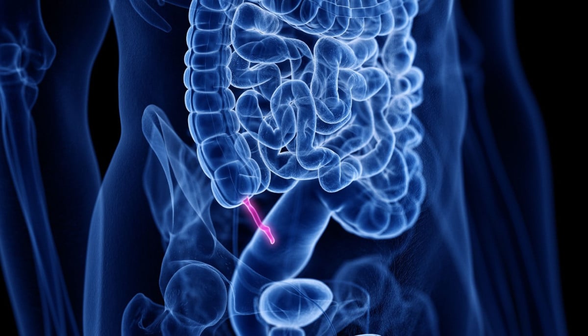 Appendix is not completely useless: Doctor explains