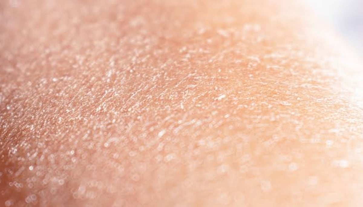 Dry skin or dehydrated skin? Expert explains key difference