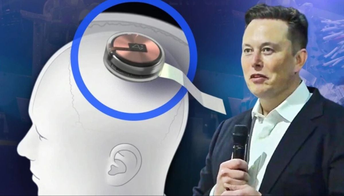 Musk's brain-chip company Neuralink faces scrutiny over unverified claims