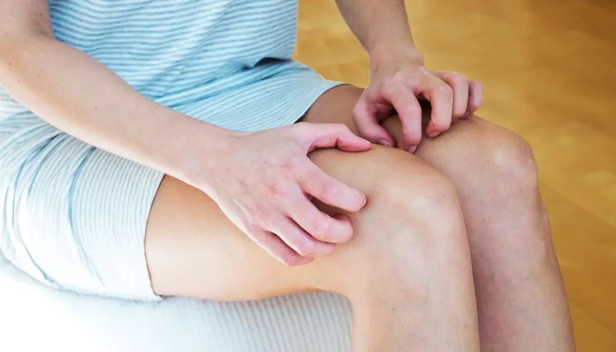 Doctor explains why exercise triggers itching in some people