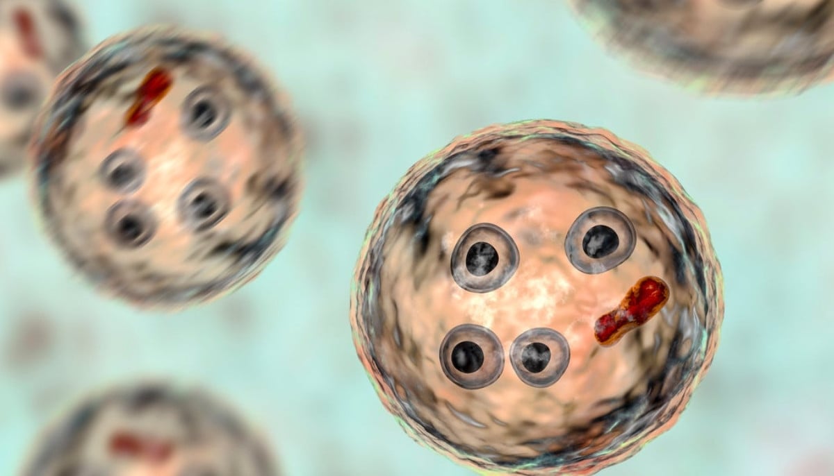 Cyclosporiasis cases surge: things to know about GI infection