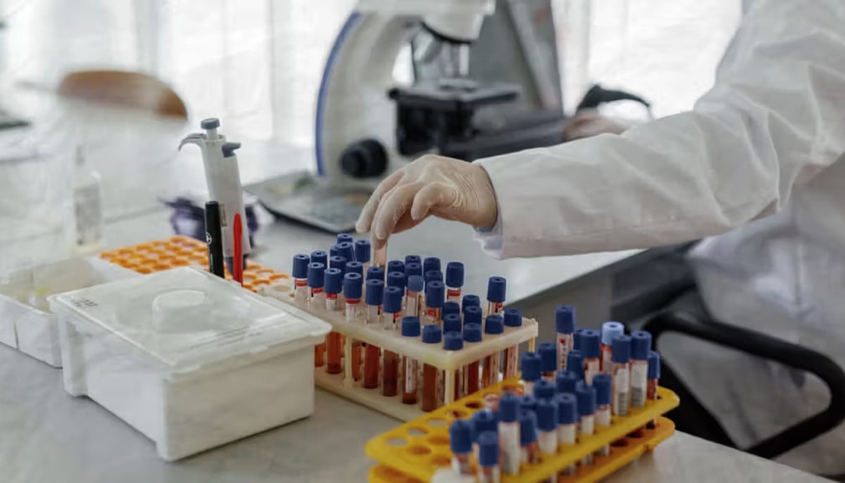 Researchers develop promising blood test for early Alzheimer's detection