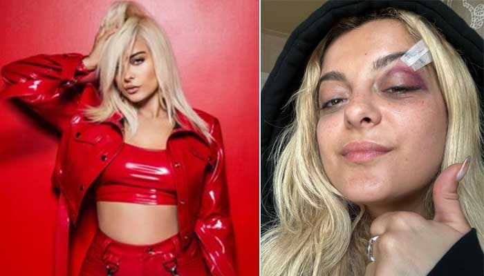 Injured Bebe Rexha updates fans after being hit by phone during NYC concert