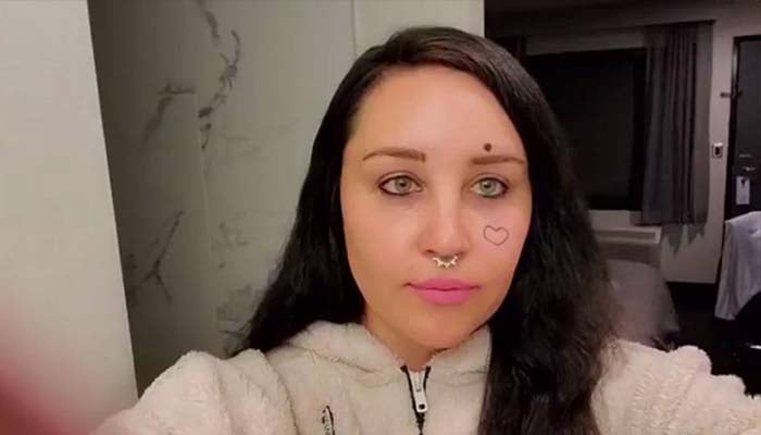 Amanda Bynes seeks to remove face tattoo, marks progress in her mental health journey
