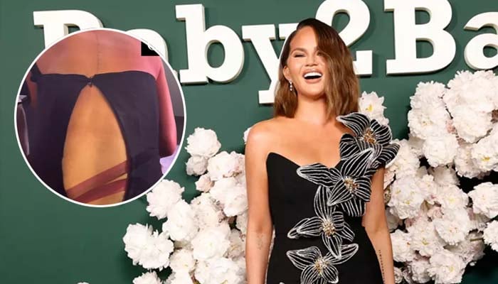 Chrissy Teigen faces hilarious wardrobe mishap at the Baby2Baby Gala
