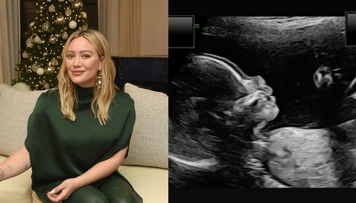 Hilary Duff reveals cute sonogram of upcoming child