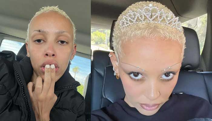 Doja Cat brother lands in trouble after knocking singers teeth out: DETAILS