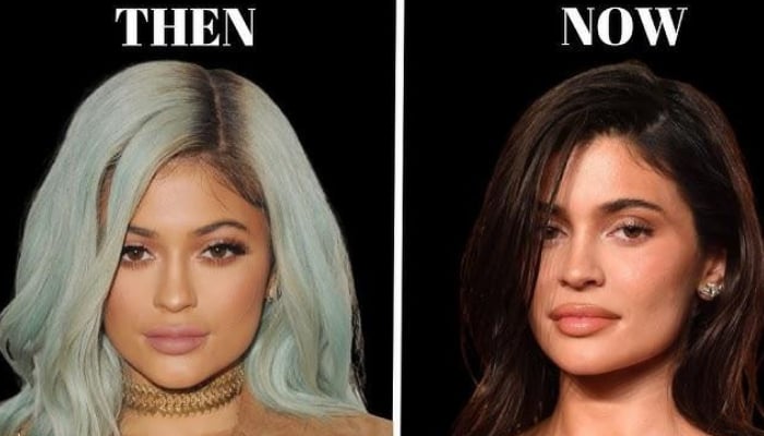 From Botox to nose jobs: How cosmetic surgery became a Hollywood obsession
