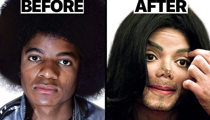 From Botox to nose jobs: How cosmetic surgery became a Hollywood obsession