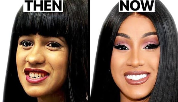 From Botox to nose jobs: How cosmetic surgery became a Hollywood obsession