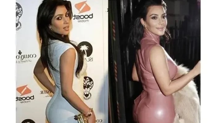 From Botox to nose jobs: How cosmetic surgery became a Hollywood obsession