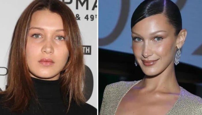 From Botox to nose jobs: How cosmetic surgery became a Hollywood obsession
