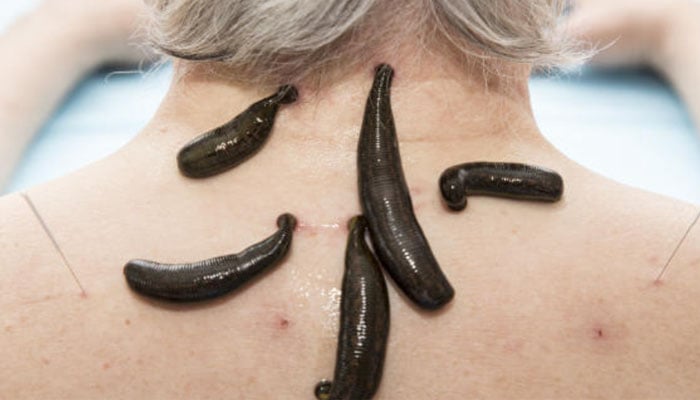 Celebrities and their craziest beauty treatments will blow you away