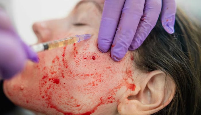 Celebrities and their craziest beauty treatments will blow you away
