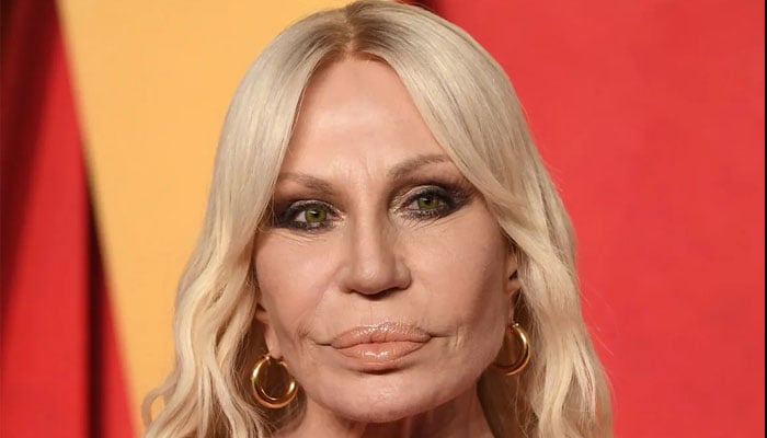 Celebrities and their Botox blunders: Stars whose facial fillers gone terribly wrong