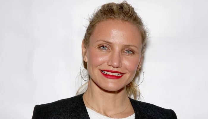 Celebrities and their Botox blunders: Stars whose facial fillers gone terribly wrong