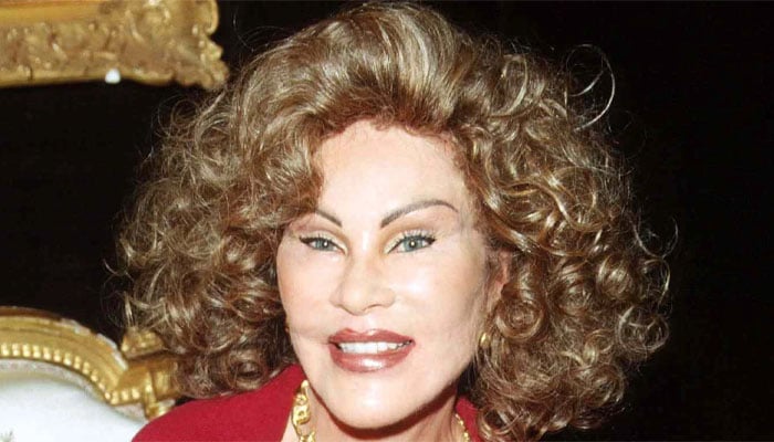 Celebrities and their Botox blunders: Stars whose facial fillers gone terribly wrong