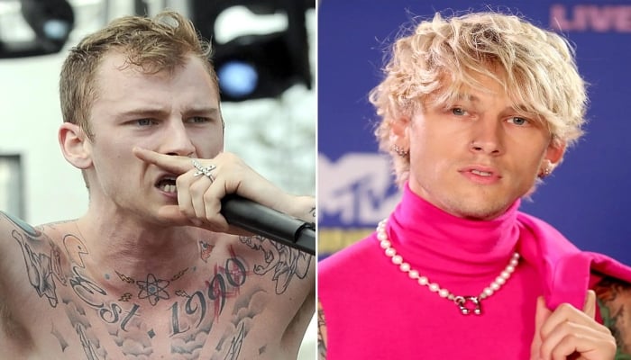 Shockingly undetectable hair transplants of your favourite male celebrities