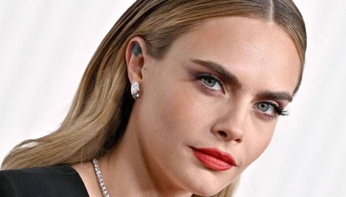 Hollywood’s stars and their hidden struggles with Psoriasis