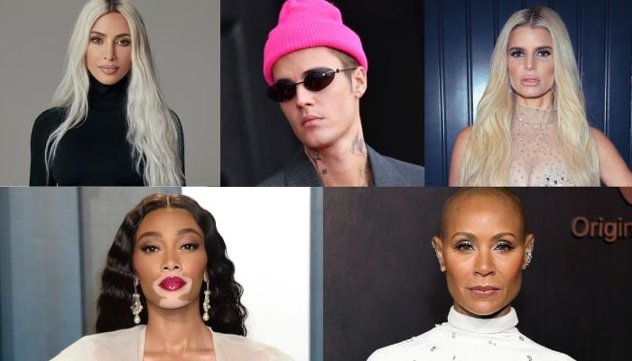 From vitiligo to eczema: Celebrities get honest about their skin conditions
